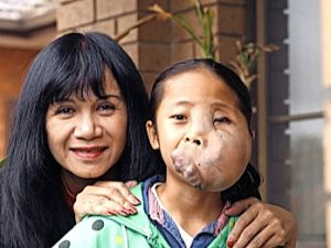 Kim’s on a mission to help restore Linh Da’s smile
