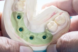IN FOCUS: Teeth: The real ins and outs