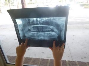 Dental waiting list times bite