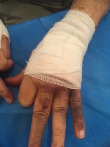 Uneven footpaths a ‘serious problem’